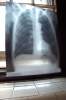 The_X-Ray.jpg